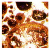 пизолиты под микроскопом